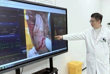 5G急救系统/院前院内协同救治天荣医疗-北京积水潭医院聊城医院智慧急救体系全面升级，急危重症能力实现新突破